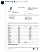 马斯克公布尿检报告，再次否认“吸毒”