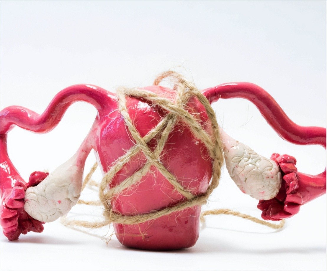 in-web_gif.jpeg in-web_gif.jpeg