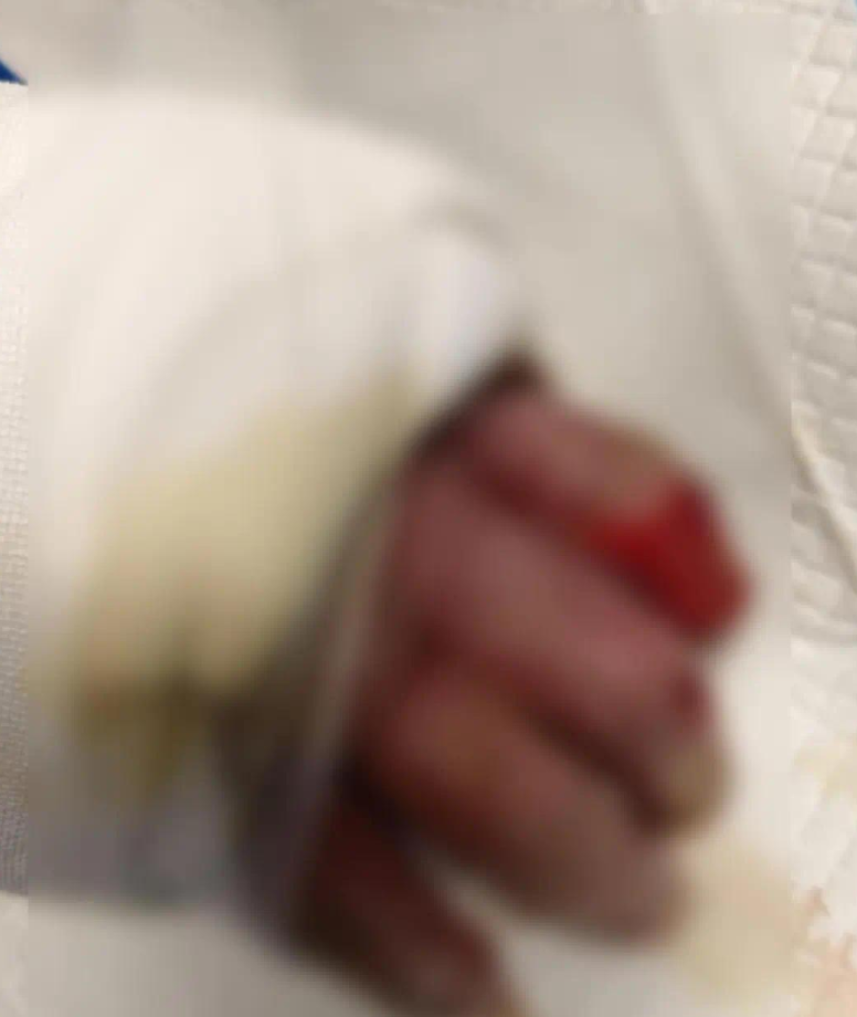 一名男子在帮助邻居关掉煤气罐时被炸成重伤4个月后去世